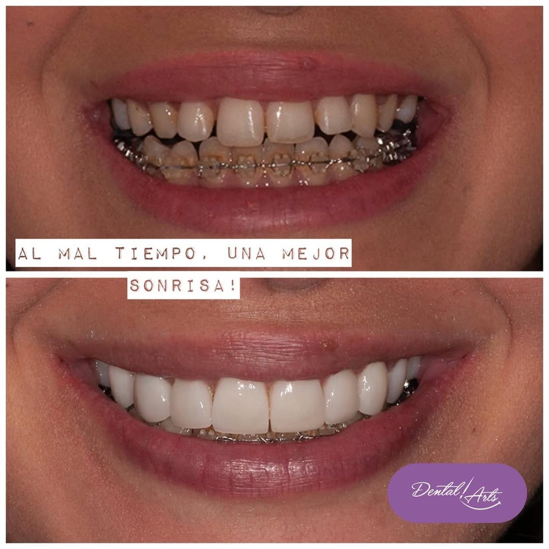 Post 2 by Dental Arts Casos De Éxito on Instagram (image)