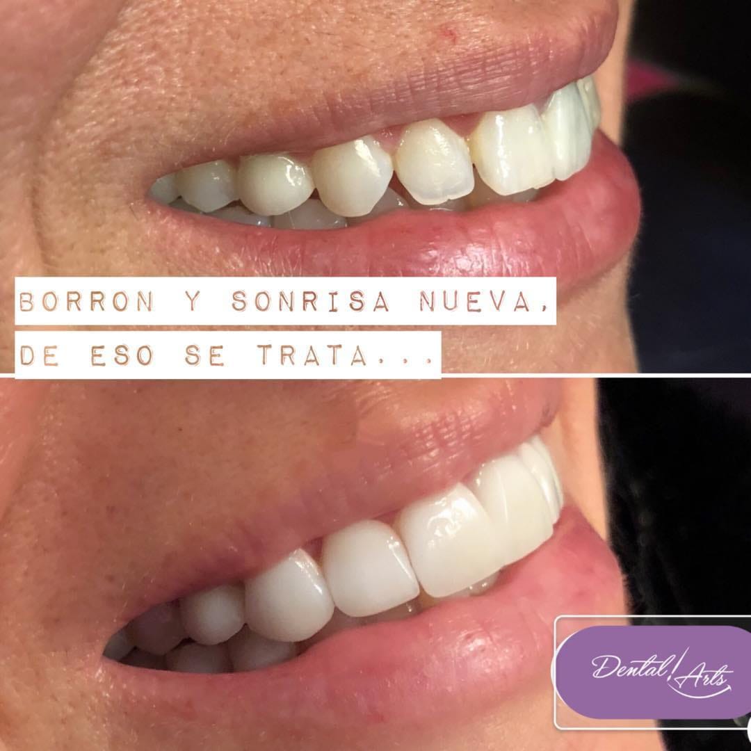 Post 6 by Dental Arts Casos De Éxito on Instagram (image)