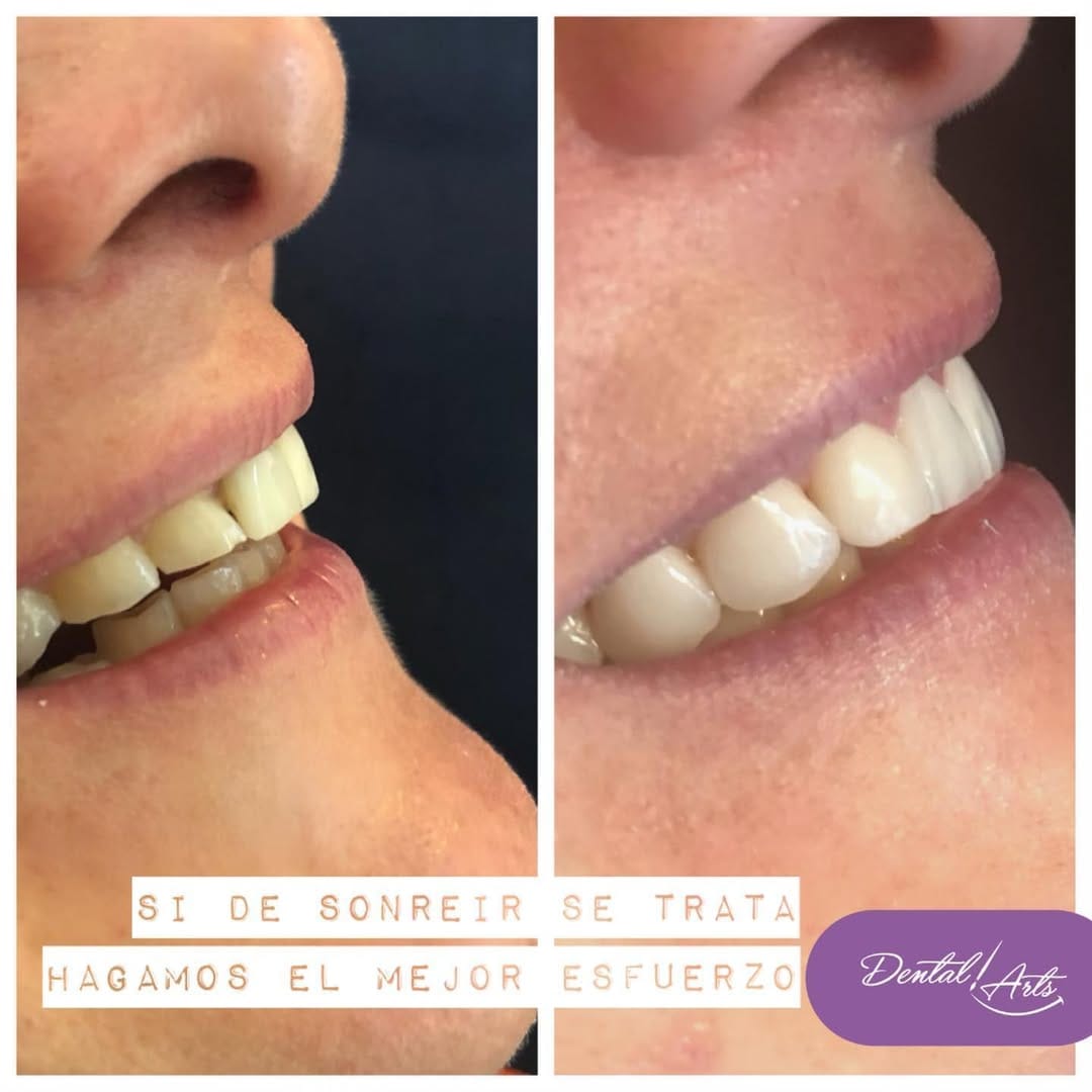 Post 5 by Dental Arts Casos De Éxito on Instagram (image)