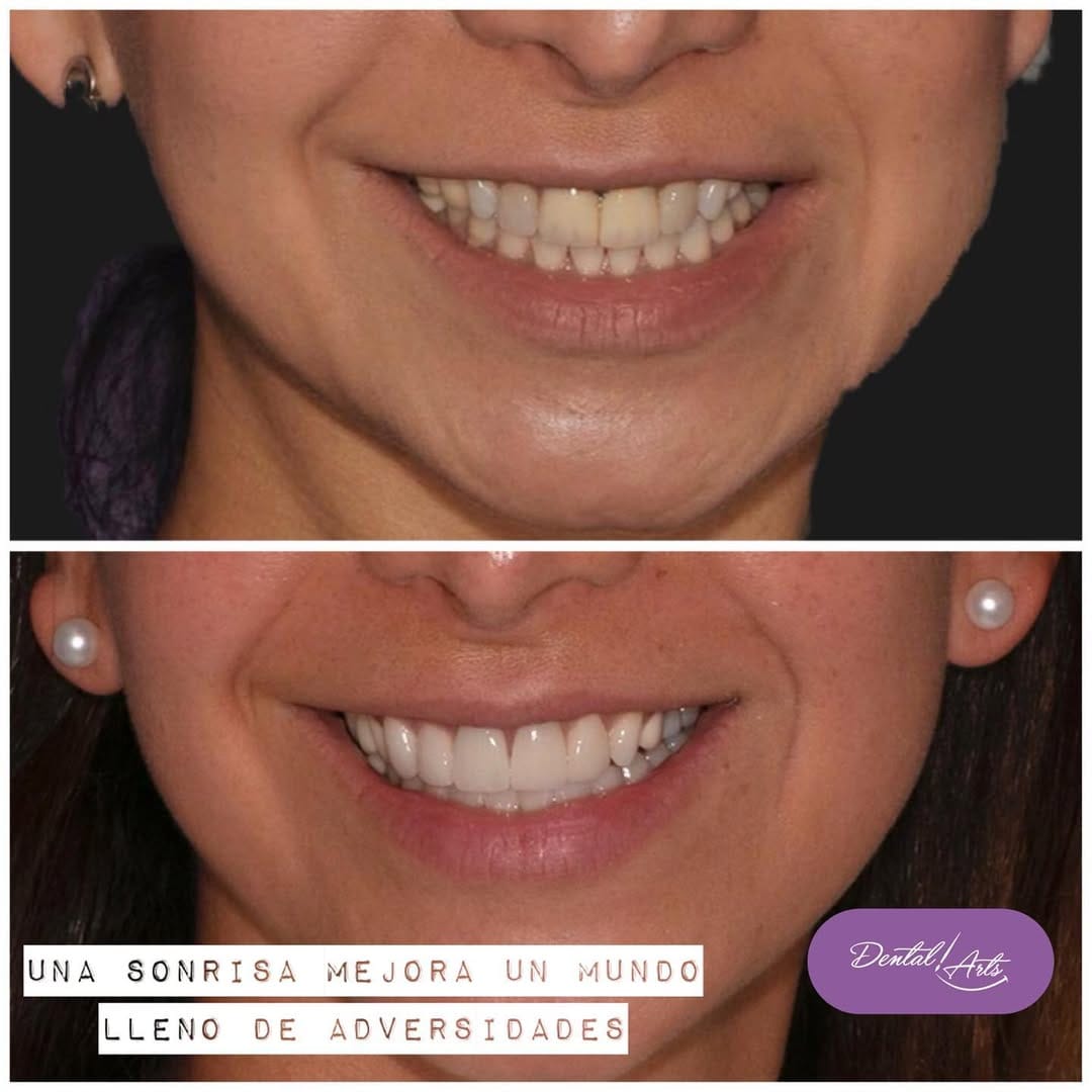 Post 3 by Dental Arts Casos De Éxito on Instagram (image)