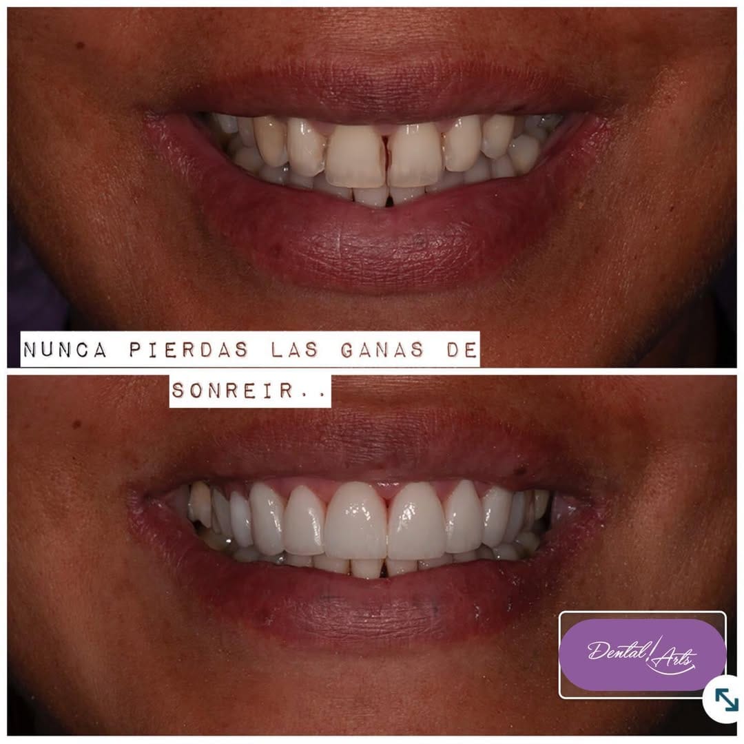 Post 4 by Dental Arts Casos De Éxito on Instagram (image)