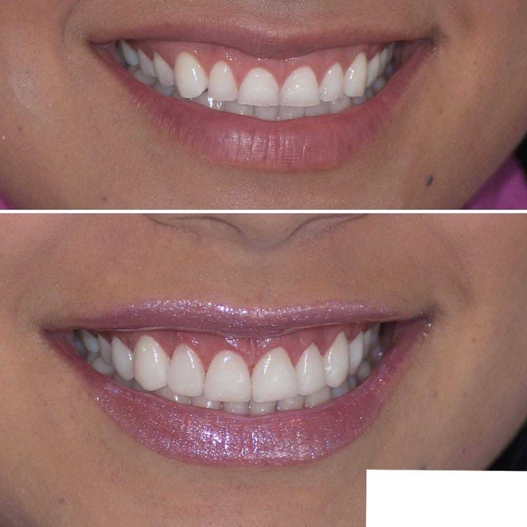 Post 8 by Dental Arts Casos De Éxito on Instagram (image)