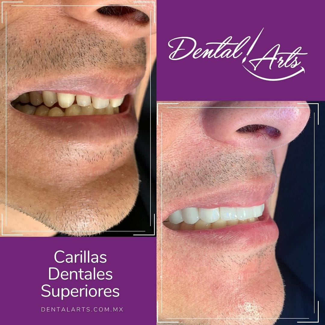 Post 1 by Dental Arts Casos De Éxito on Instagram (image)