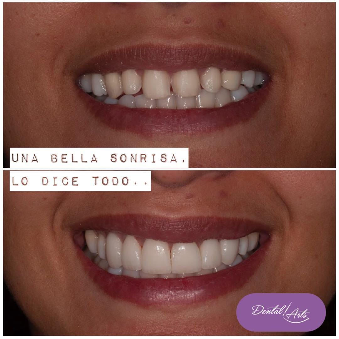 Post 7 by Dental Arts Casos De Éxito on Instagram (image)