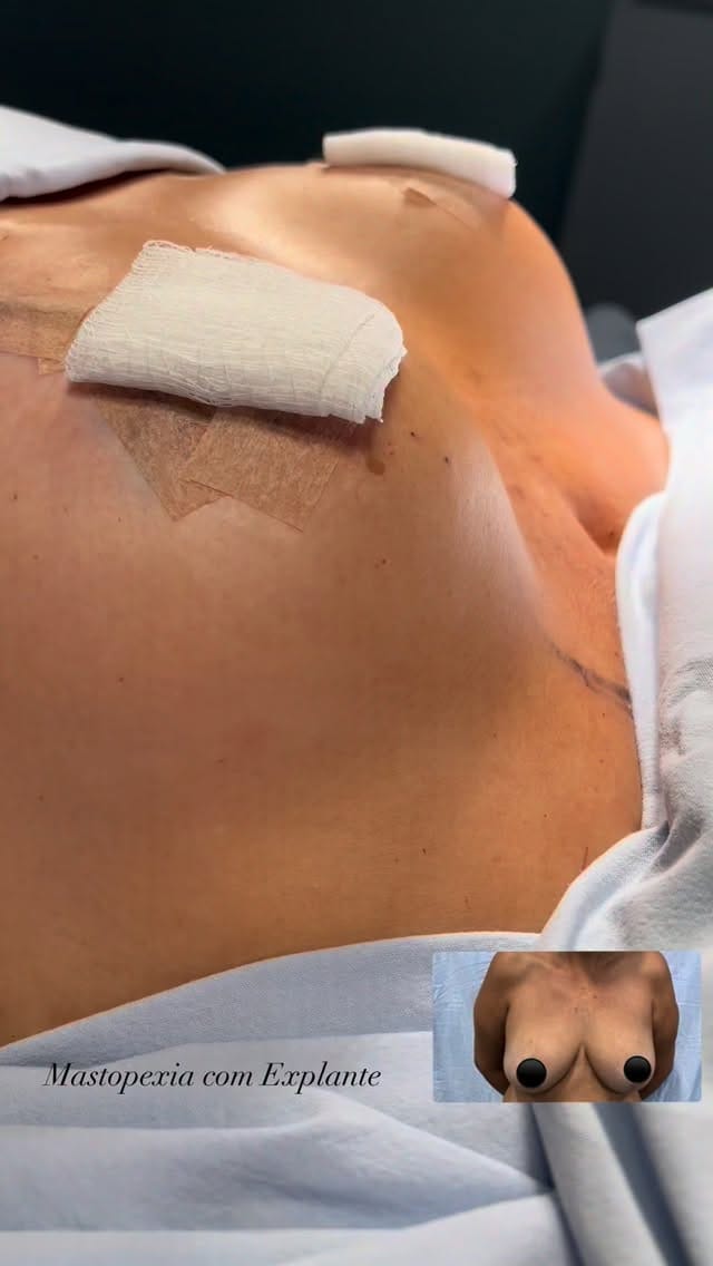 Post 4 by Ludmila Leite Sant'Anna Vaz de Mello on Instagram (video)