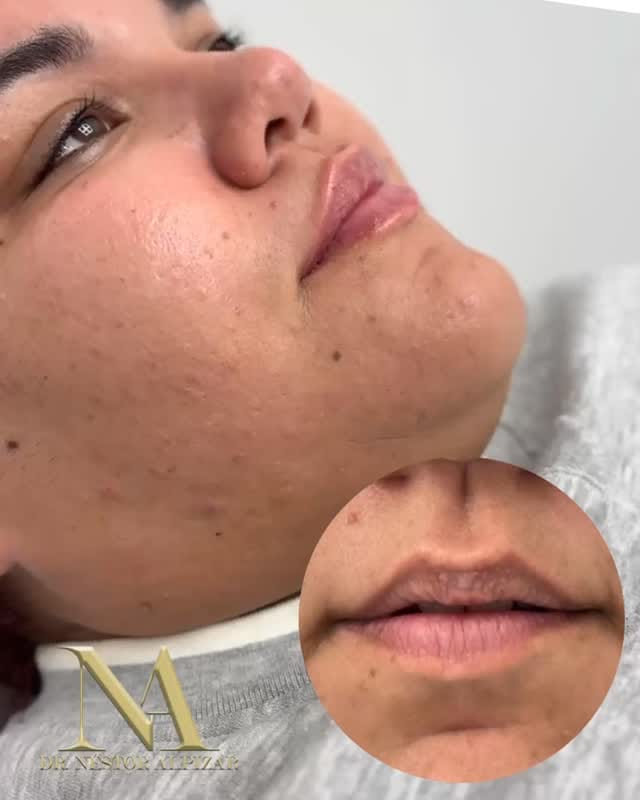 Post 1 by Dr Nestor Alpizar Calzadilla on Instagram (video)