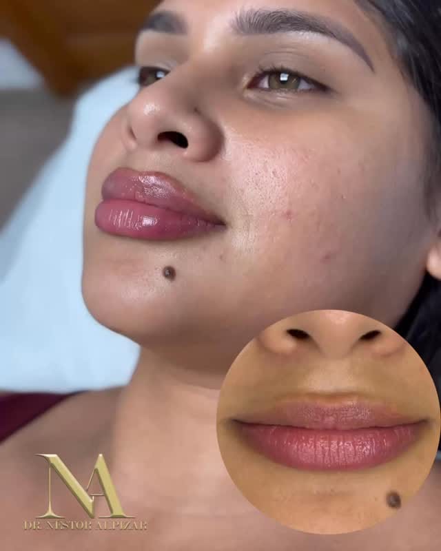 Post 4 by Dr Nestor Alpizar Calzadilla on Instagram (video)