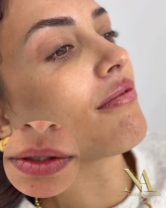 Post 2 by Dr Nestor Alpizar Calzadilla on Instagram (video)