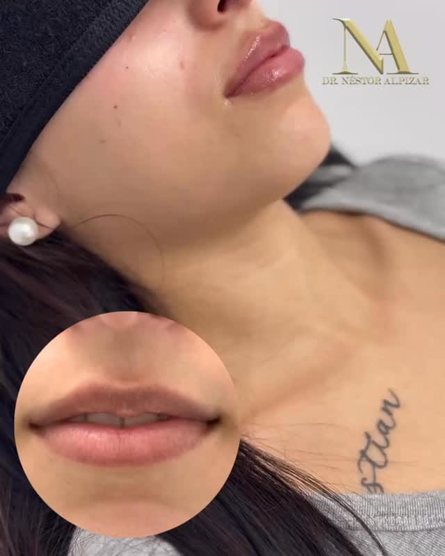 Post 10 by Dr Nestor Alpizar Calzadilla on Instagram (video)