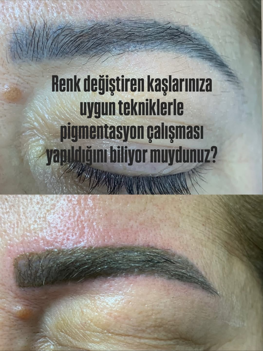 Post 10 by Emrah Atak on Instagram (image)