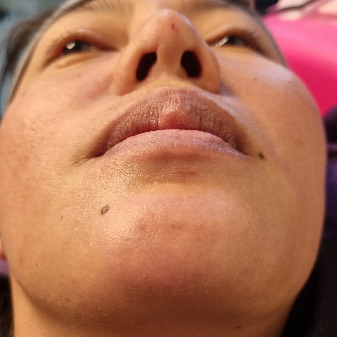 Post 8 by @jasabotoxfiler on Instagram (image)