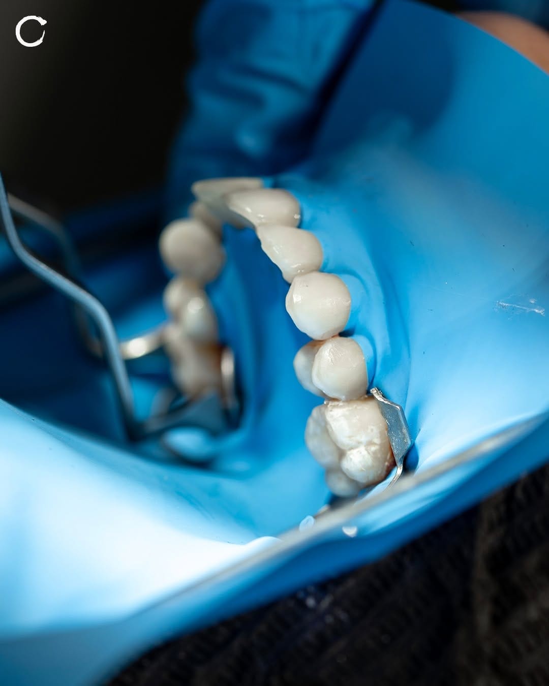 Post 3 by Zental | Dentistas 🦷 on Instagram (image)
