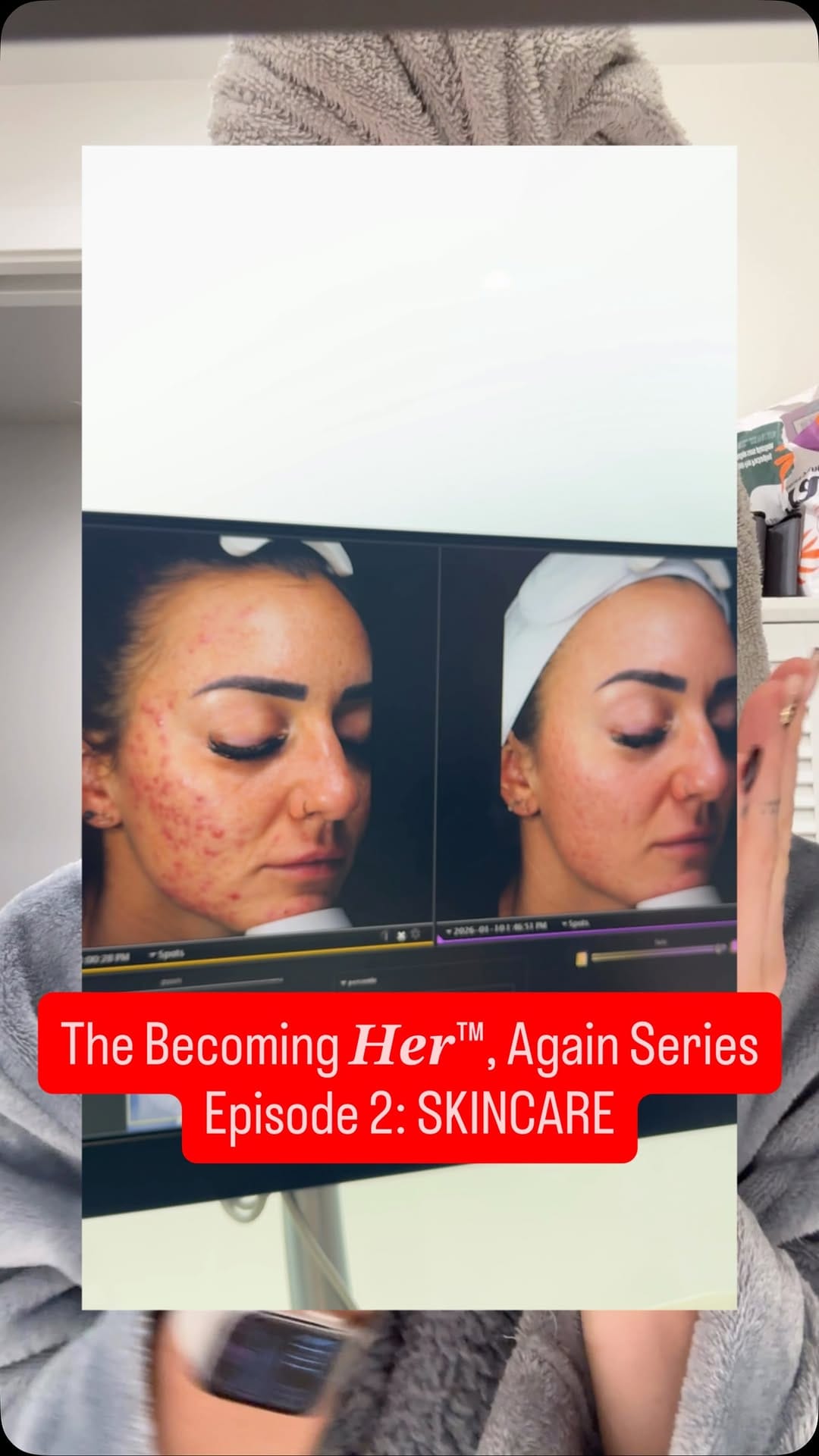 Post 2 by GLO Antiaging Youth Lab on Instagram (video)
