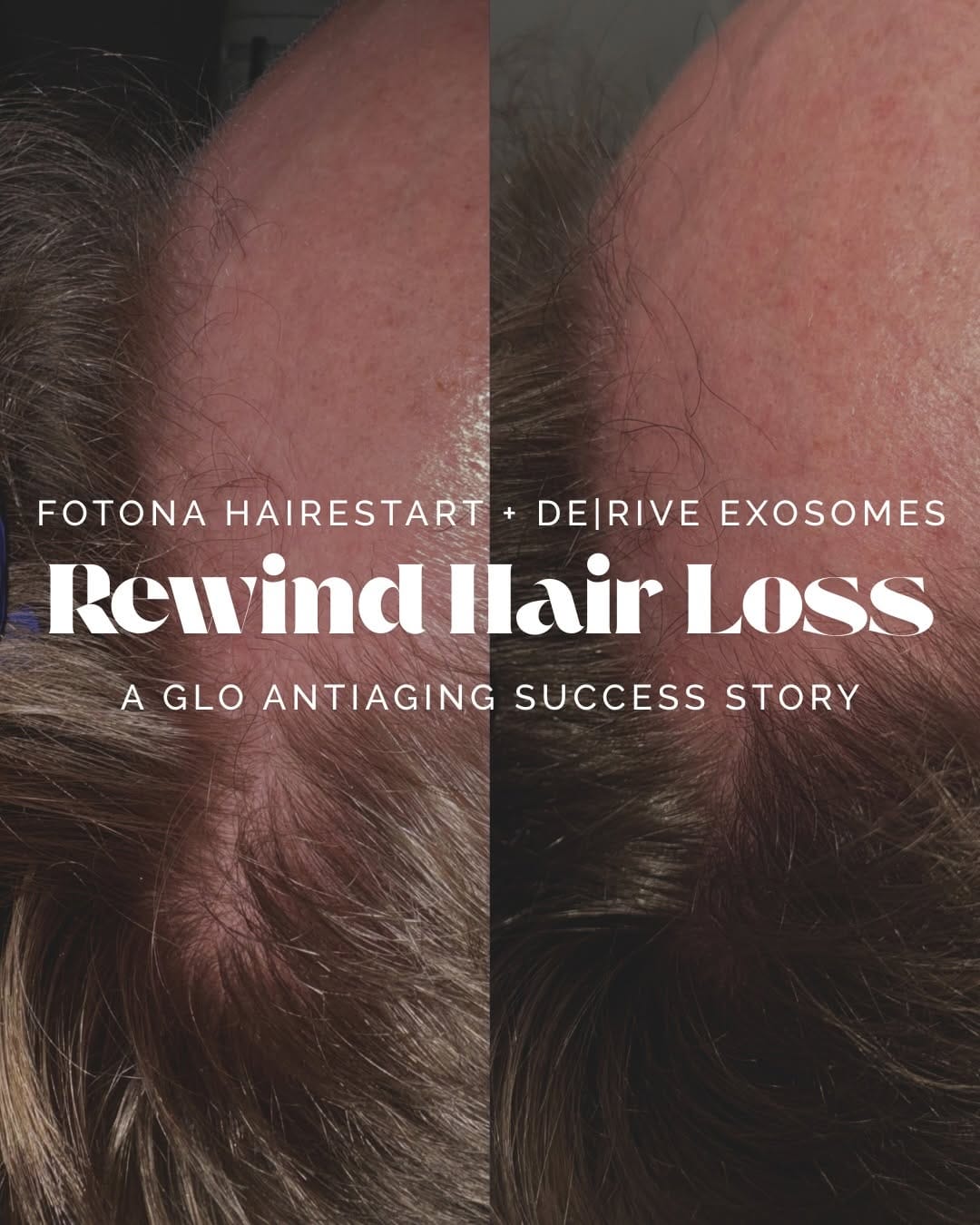 Post 3 by GLO Antiaging Youth Lab on Instagram (carousel)