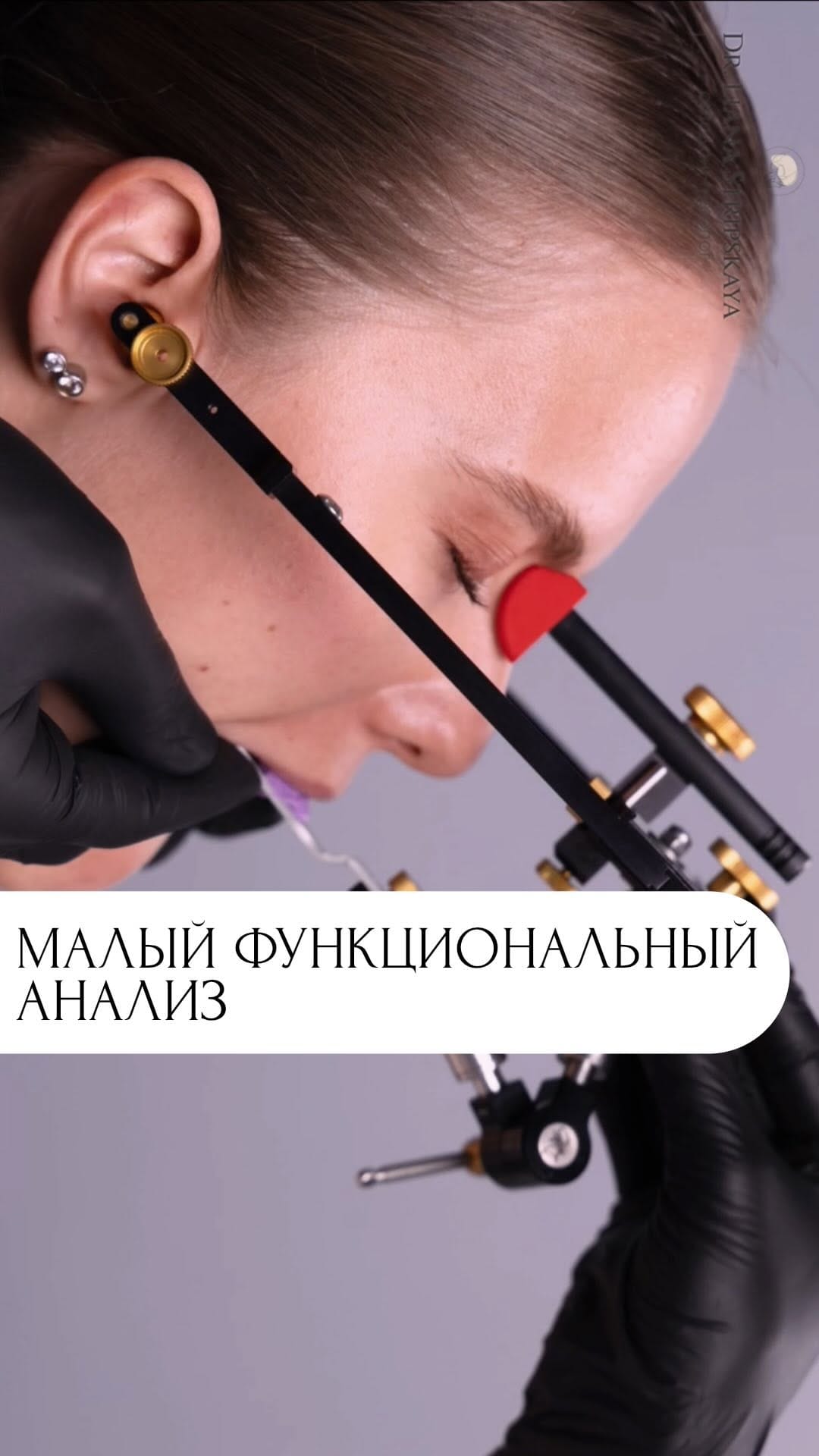 Post 8 by ОРТОДОНТ-ГНАТОЛОГ | МОСКВА on Instagram (video)