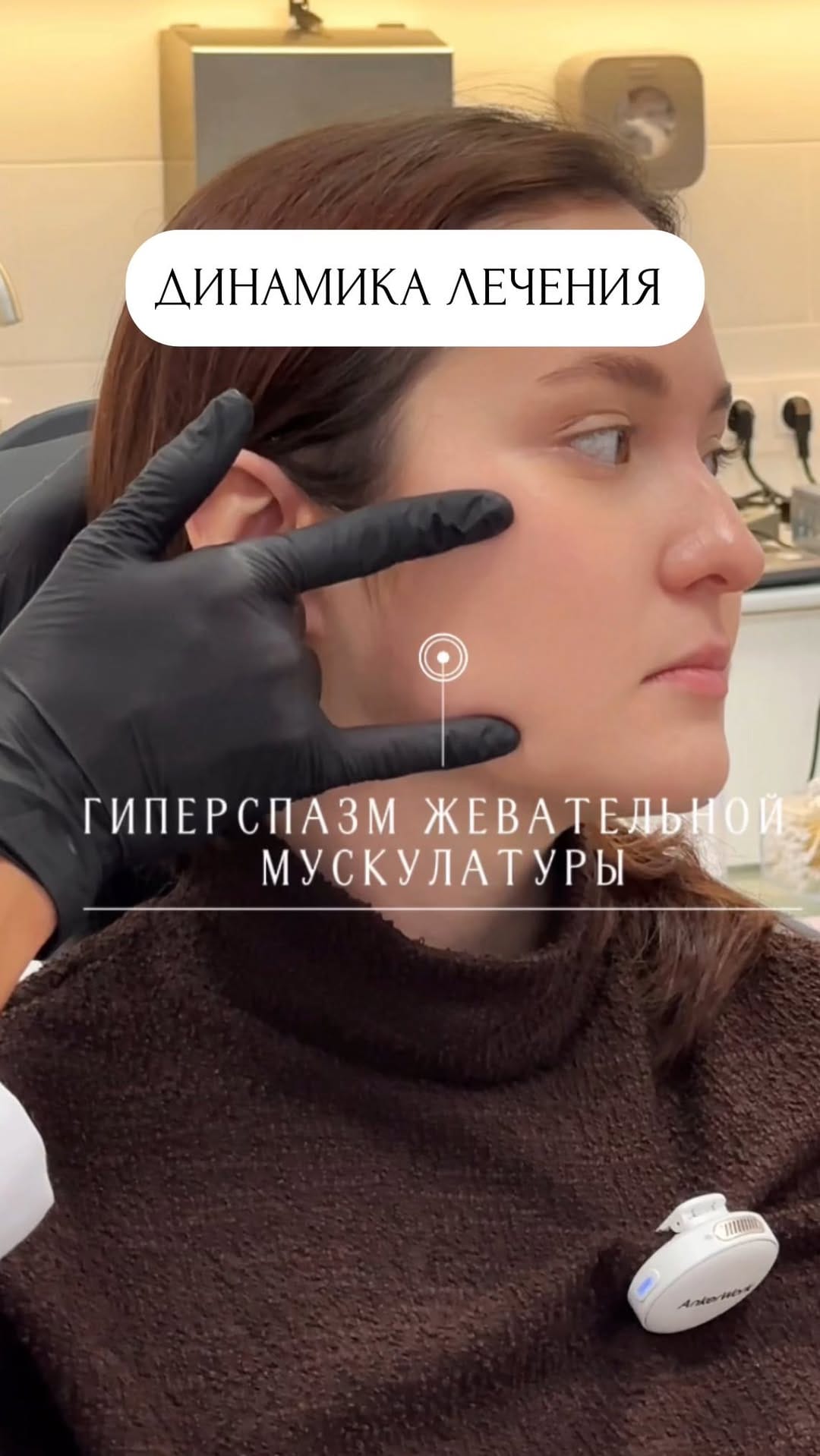 Post 6 by ОРТОДОНТ-ГНАТОЛОГ | МОСКВА on Instagram (video)