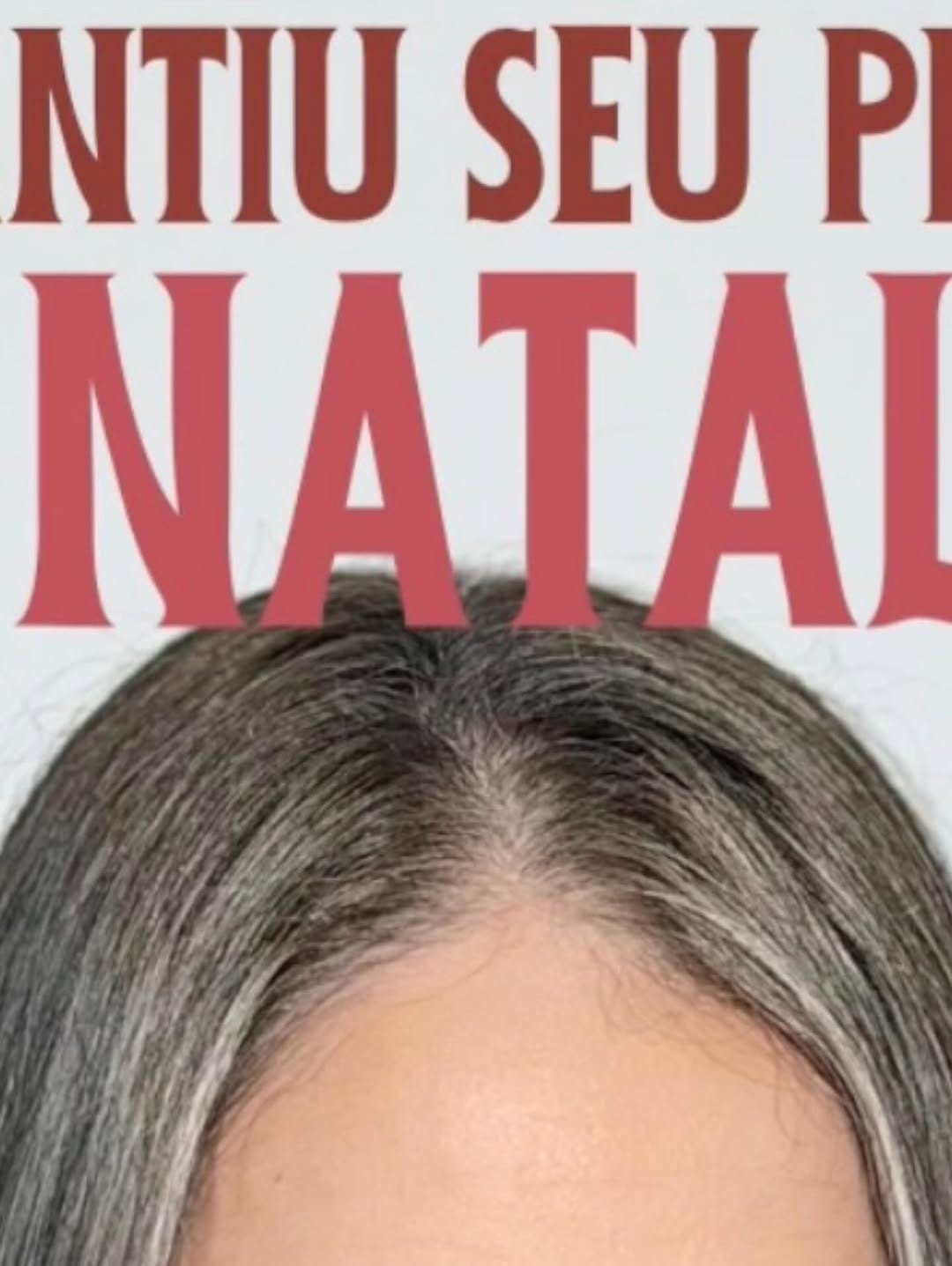 Post 5 by Centro Estetico Paula Gomes on Instagram (image)