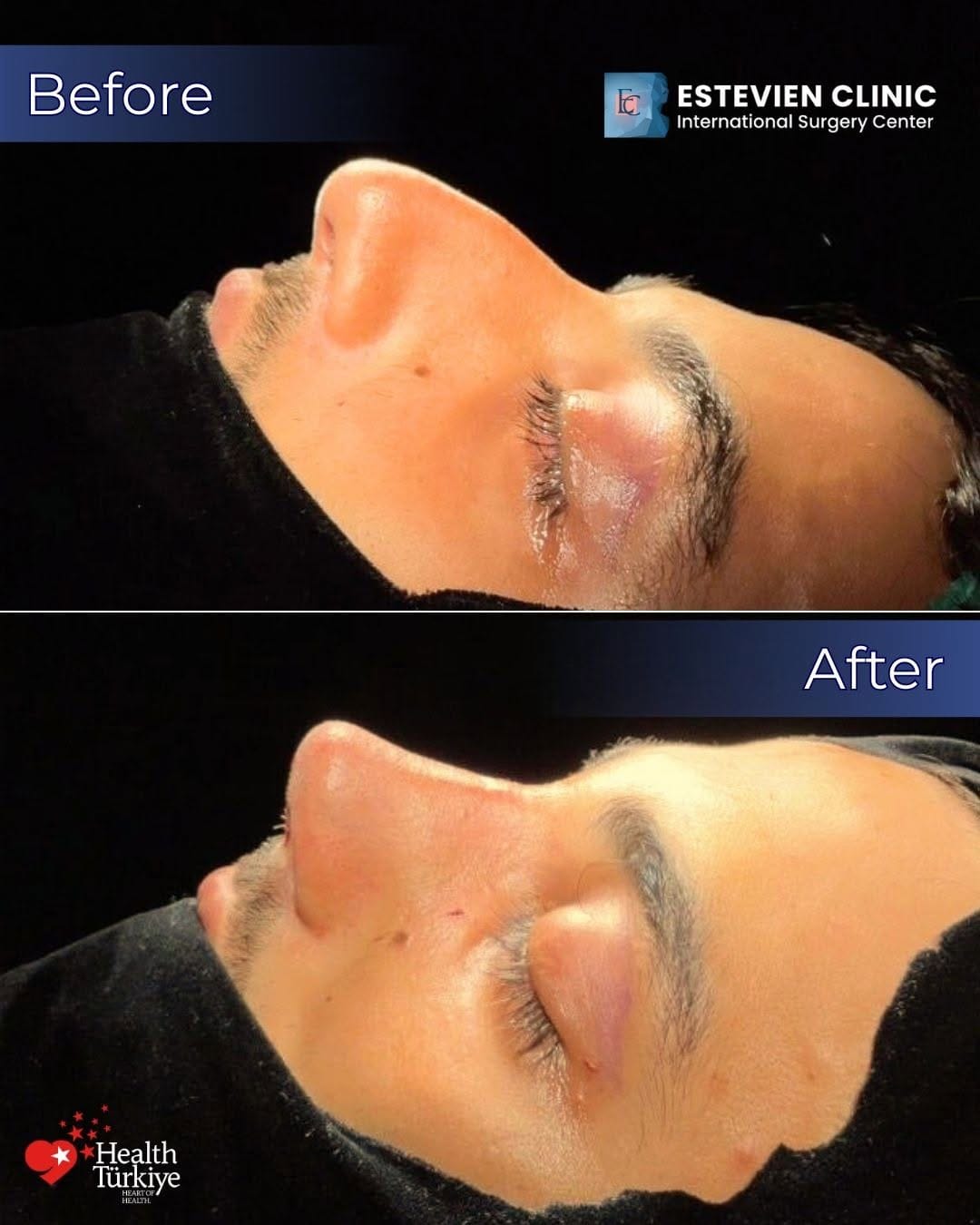 Post 7 by Estevien Clinic on Instagram (image)