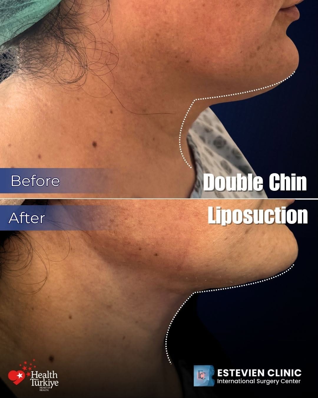Post 10 by Estevien Clinic on Instagram (image)