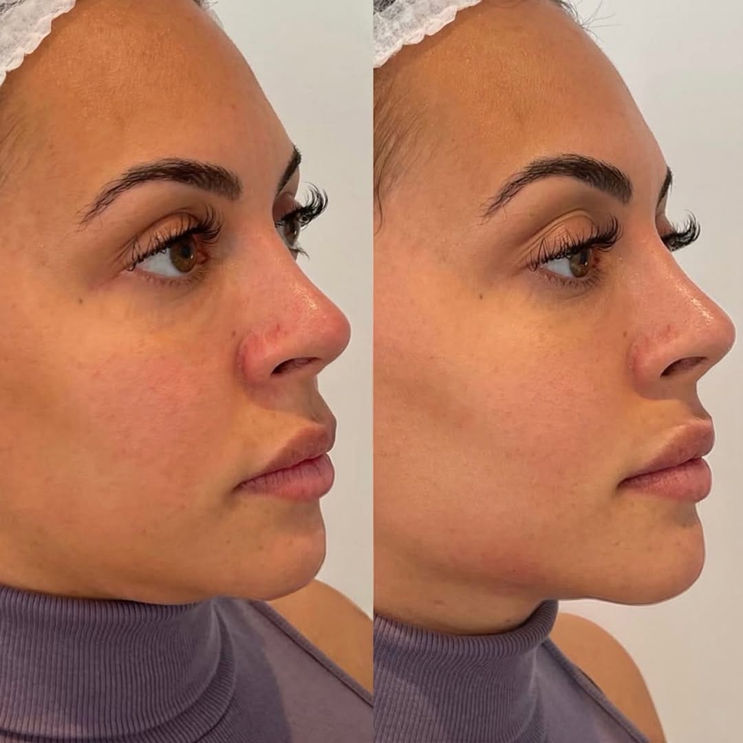 Post 8 by Dra. Jéssica Domingues | Embelezamento | São Paulo/SP on Instagram (carousel)