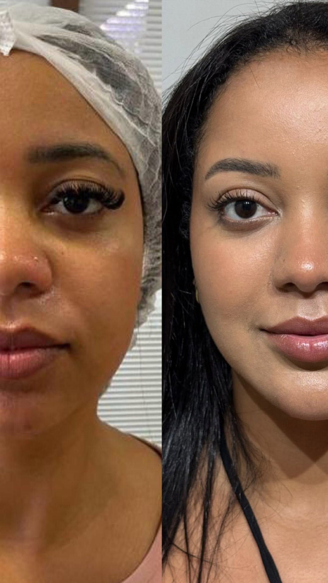 Post 9 by Dra. Jéssica Domingues | Embelezamento | São Paulo/SP on Instagram (video)