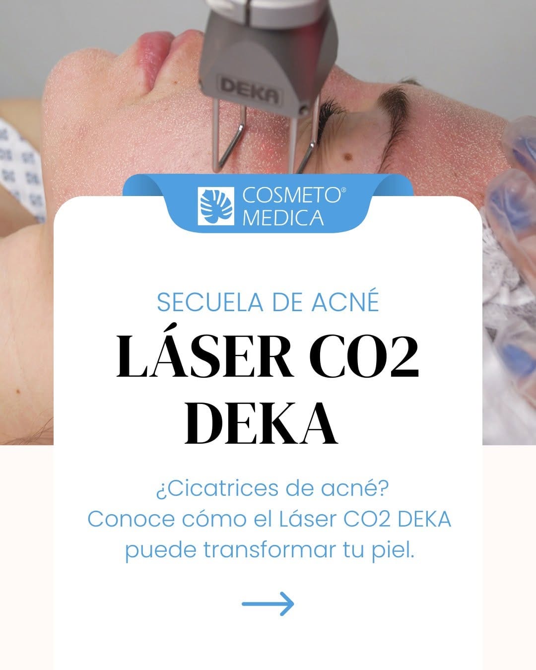 Post 3 by Cosmetomedica | Clínica de belleza en Guadalajara on Instagram (carousel)