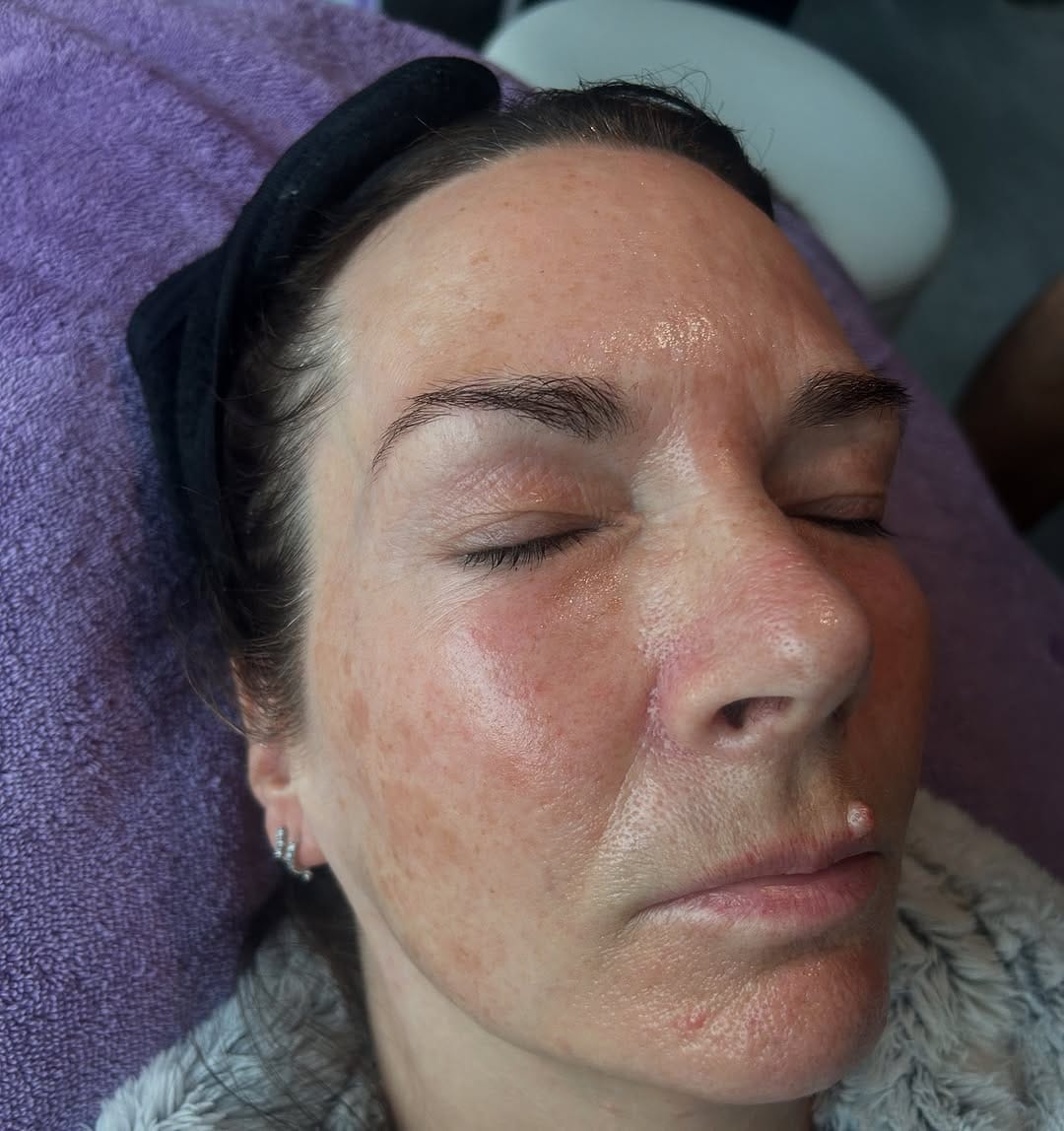 Post 1 by @skinbypoppy on Instagram (image)