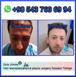 Post 2 by Este Jimmy on Instagram (video)
