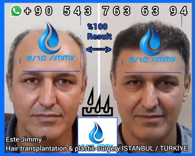 Post 1 by Este Jimmy on Instagram (video)