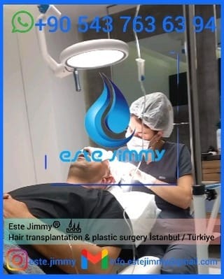 Post 8 by Este Jimmy on Instagram (video)