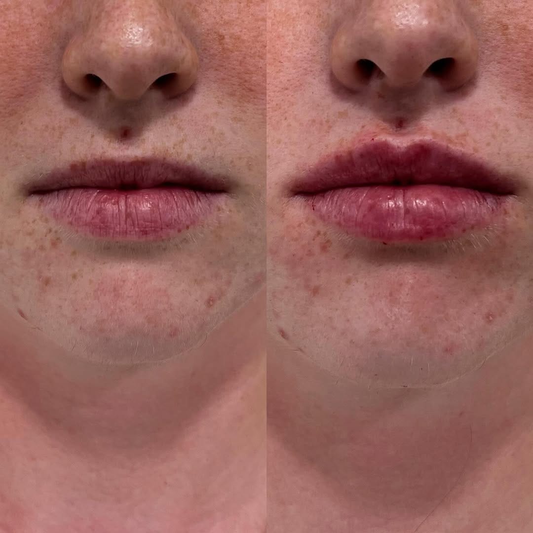 Post 3 by Doctora experta en labios on Instagram (image)