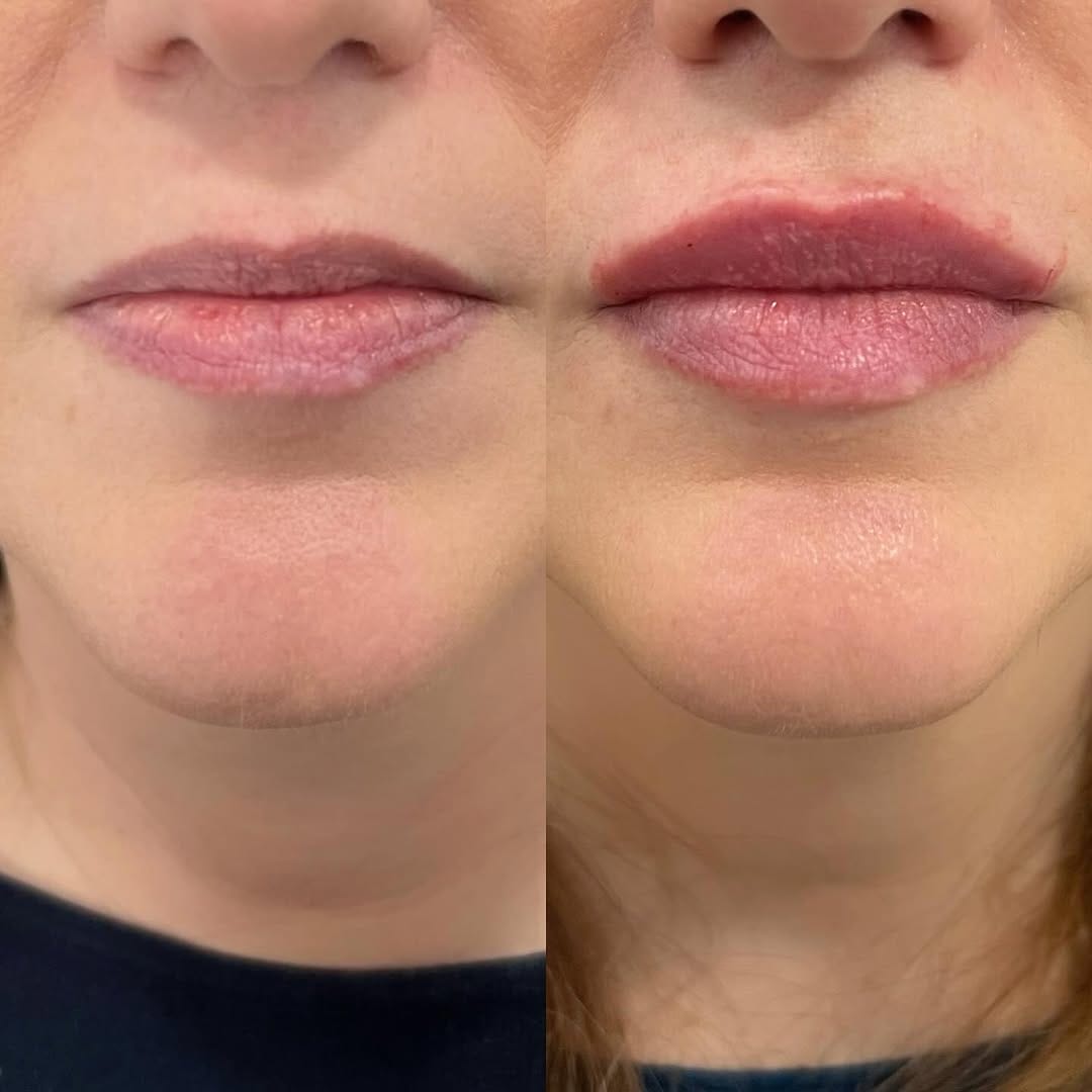 Post 5 by Doctora experta en labios on Instagram (image)