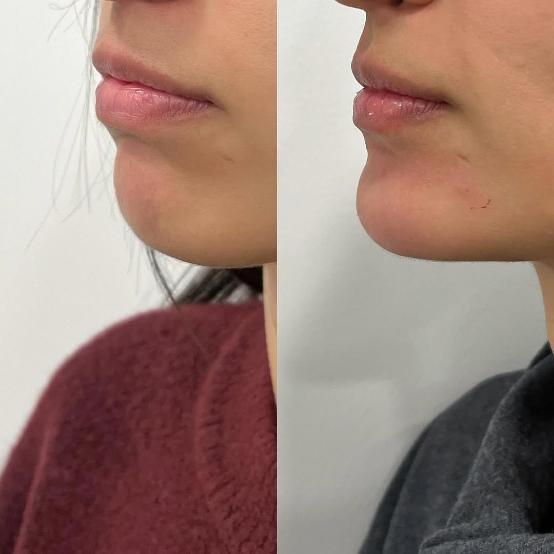 Post 6 by Doctora experta en labios on Instagram (carousel)