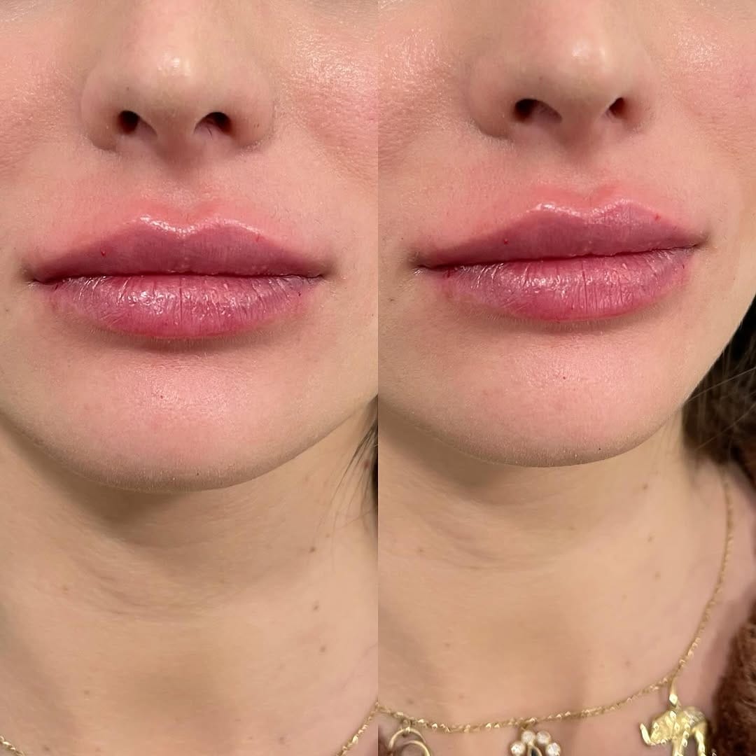 Post 9 by Doctora experta en labios on Instagram (image)