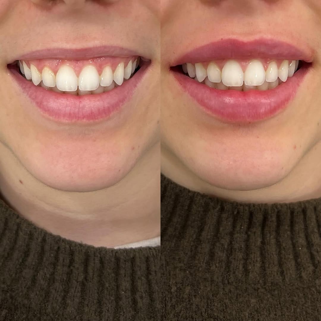 Post 7 by Doctora experta en labios on Instagram (image)