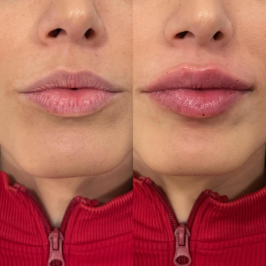 Post 2 by Doctora experta en labios on Instagram (image)