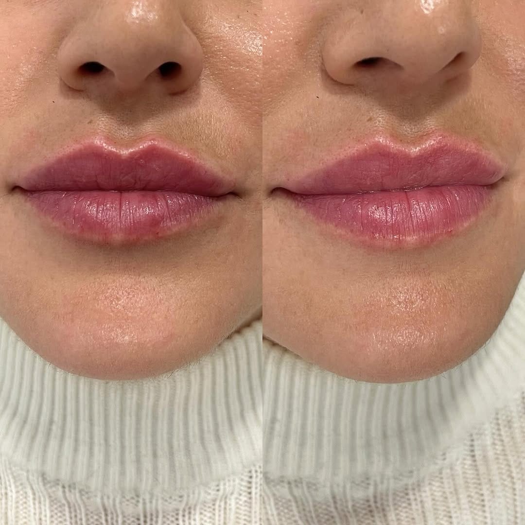 Post 8 by Doctora experta en labios on Instagram (image)