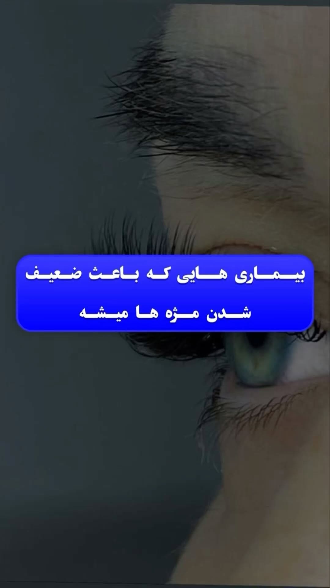 Post 7 by آکادمی تخصصی اکستنشن مژه و فیبروز on Instagram (video)