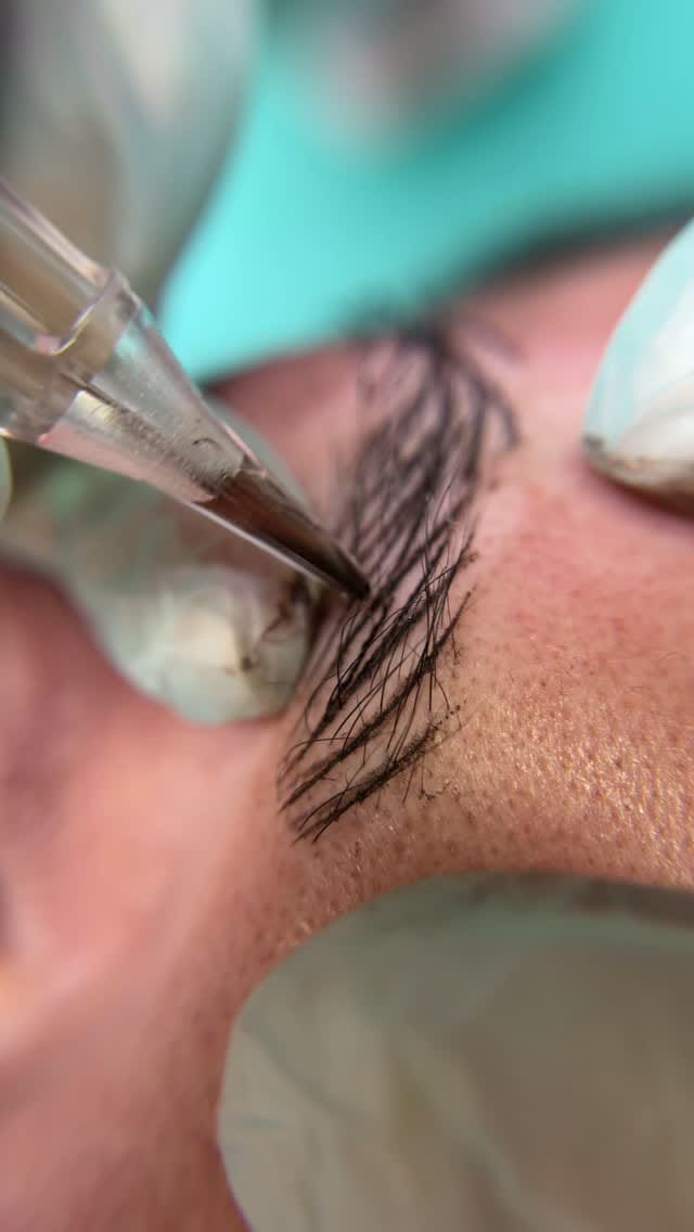 Post 6 by Belén Ébanne Academia  Clínica Medicina estética on Instagram (video)
