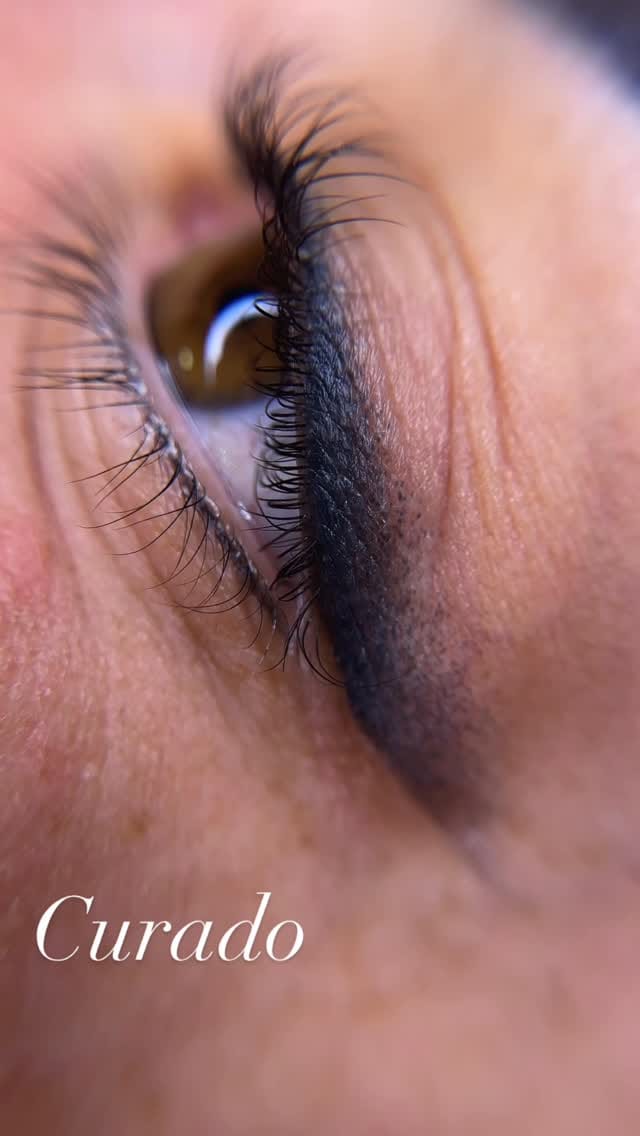Post 7 by Belén Ébanne Academia  Clínica Medicina estética on Instagram (video)