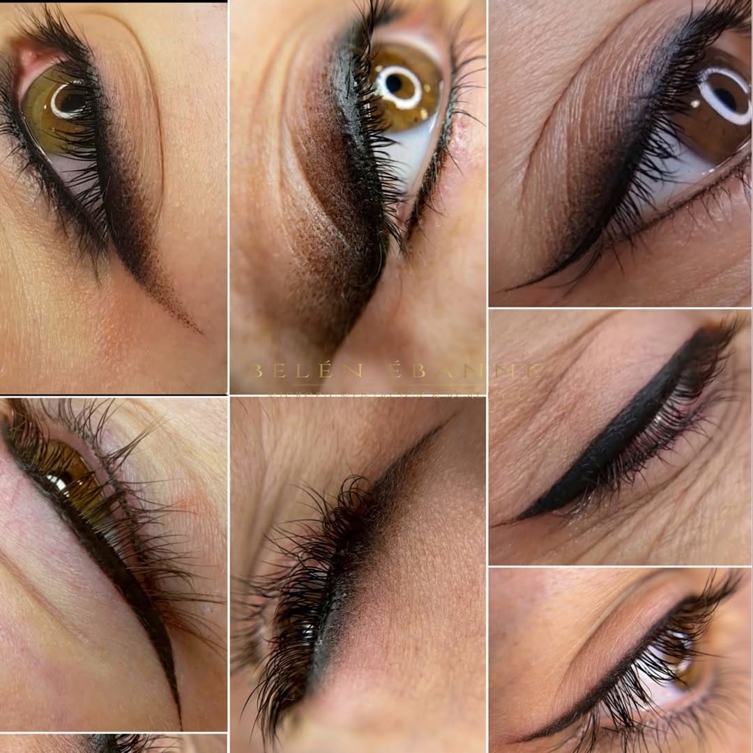 Post 10 by Belén Ébanne Academia  Clínica Medicina estética on Instagram (image)