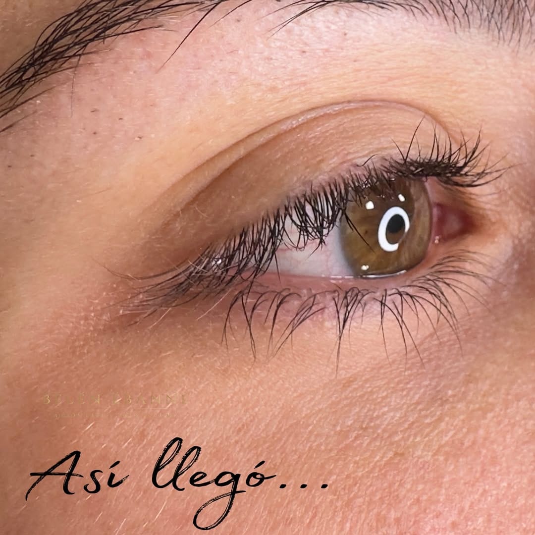 Post 3 by Belén Ébanne Academia  Clínica Medicina estética on Instagram (carousel)