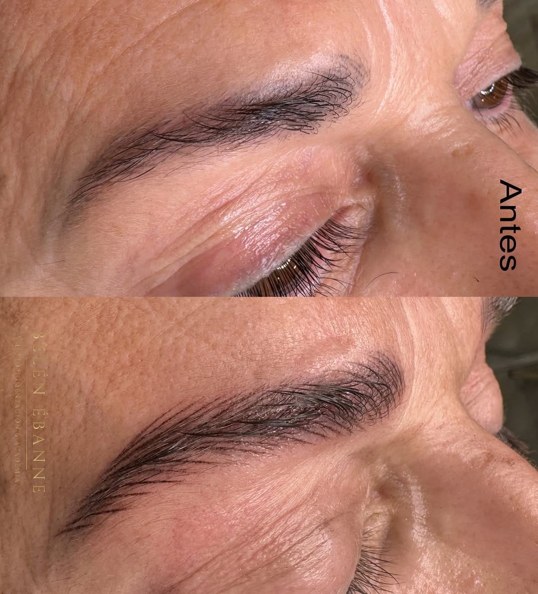 Post 4 by Belén Ébanne Academia  Clínica Medicina estética on Instagram (carousel)