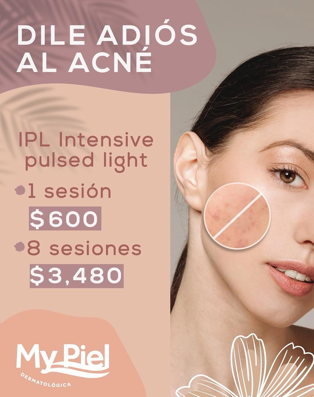 Post 6 by My Piel Dermatológica on Instagram (image)