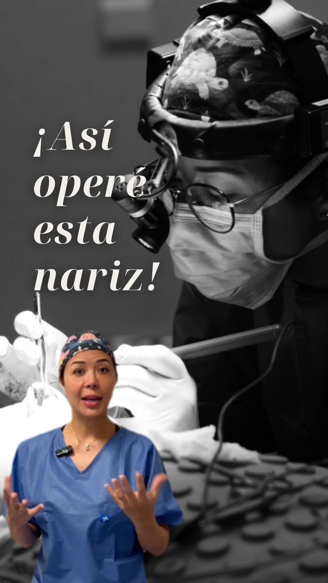 Post 5 by Maria T. Achiques | Rinoplastia on Instagram (video)