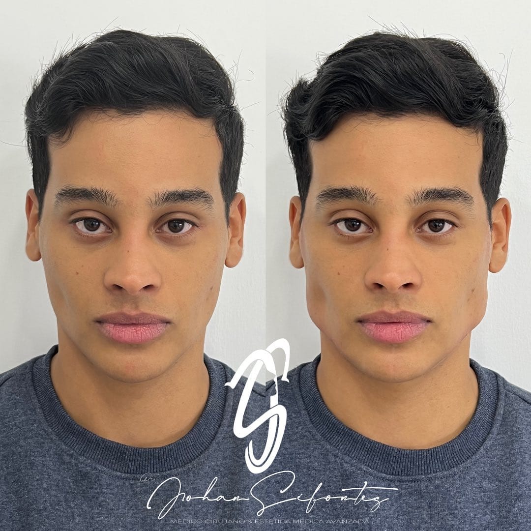 Post 10 by Dr Johan Sifontes on Instagram (image)