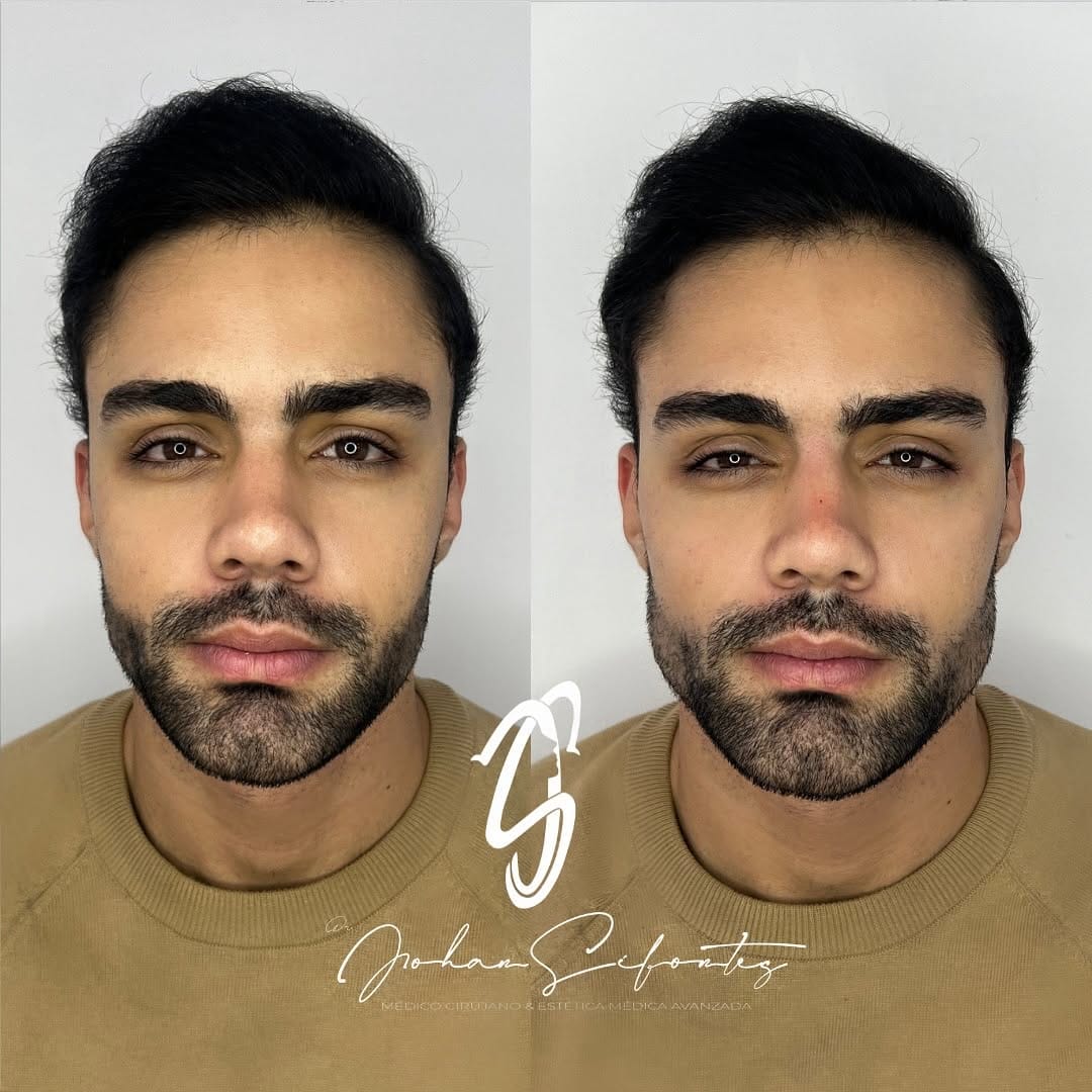 Post 8 by Dr Johan Sifontes on Instagram (image)