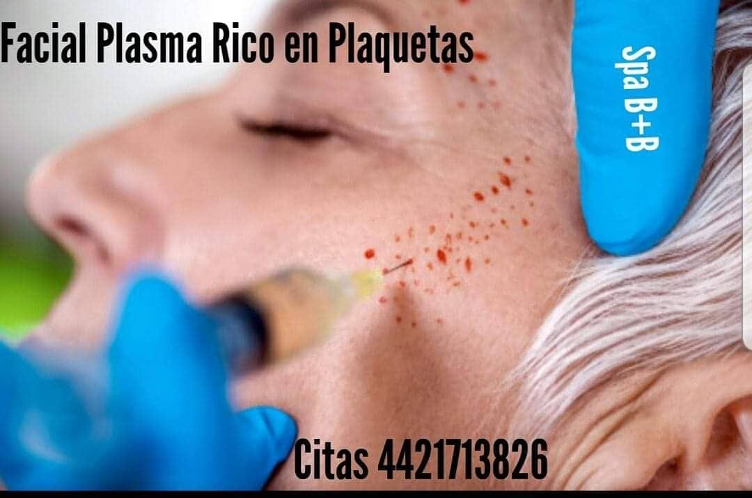 Post 2 by Spa en Queretaro on Instagram (image)