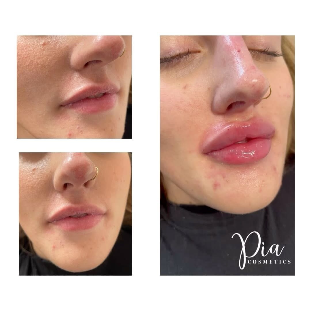 Post 3 by Aesthetics & Beauty By Pia 💋 on Instagram (video)