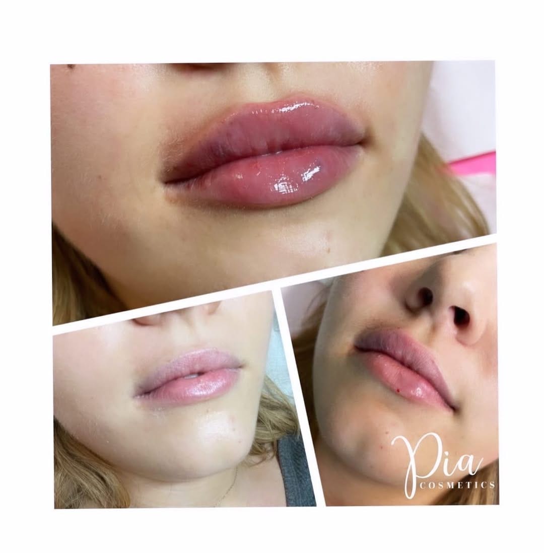 Post 6 by Aesthetics & Beauty By Pia 💋 on Instagram (image)